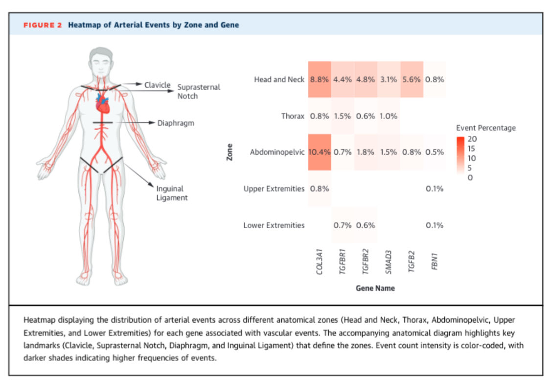 Edgardo Alania (@ed_alania) on Twitter photo 🔴 Differences in Arterial Events in Vascular Ehlers-Danlos, Loeys-Dietz, & Marfan Syndrome <a href="/JACCJournals/">JACC Journals</a> #Cardiology #cardioEd #FOAMed <a href="/OuzounianMD/">Maral Ouzounian</a> #Marfan #EhlersDanlos 🔴 Differences in Arterial Events in Vascular Ehlers-Danlos, Loeys-Dietz, & Marfan Syndrome <a href="/JACCJournals/">JACC Journals</a> #Cardiology #cardioEd #FOAMed <a href="/OuzounianMD/">Maral Ouzounian</a> #Marfan #EhlersDanlos