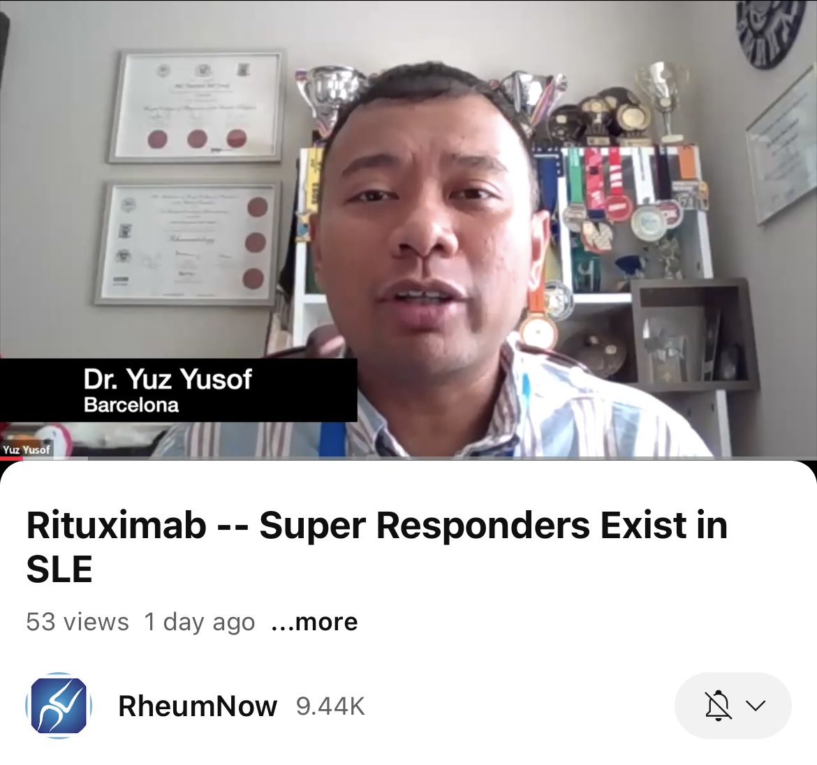 Md Yuzaiful Md Yusof (@yuz6yusof) on Twitter photo #EULAR2025 Rituximab super responders (>3 years duration) exist after one cycle of therapy in #SLE. Please find my video summary <a href="/RheumNow/">Dr. John Cush</a>
youtu.be/iroaG1cvAXk?si… #EULAR2025 Rituximab super responders (>3 years duration) exist after one cycle of therapy in #SLE. Please find my video summary <a href="/RheumNow/">Dr. John Cush</a>
youtu.be/iroaG1cvAXk?si…