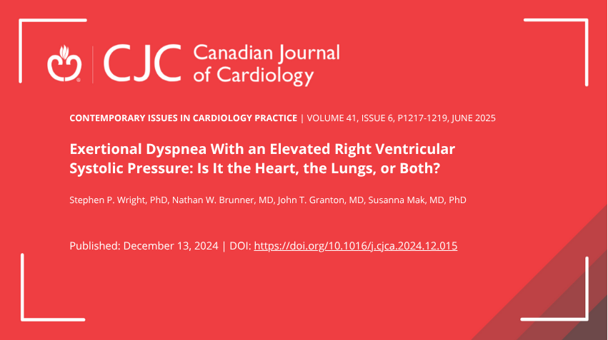 CJC Journals (@cjcjournals) on Twitter photo 🫀 Exertional dyspnea with an elevated right ventricular systolic pressure: is it the heart, the lungs, or both? ⬇️
onlinecjc.ca/article/S0828-…
<a href="/CardioUBC/">UBC Cardiology</a> <a href="/UofTCardio/">UofTCardio</a> #ThePeoplesVentricle #CJC 🫀 Exertional dyspnea with an elevated right ventricular systolic pressure: is it the heart, the lungs, or both? ⬇️
onlinecjc.ca/article/S0828-…
<a href="/CardioUBC/">UBC Cardiology</a> <a href="/UofTCardio/">UofTCardio</a> #ThePeoplesVentricle #CJC
