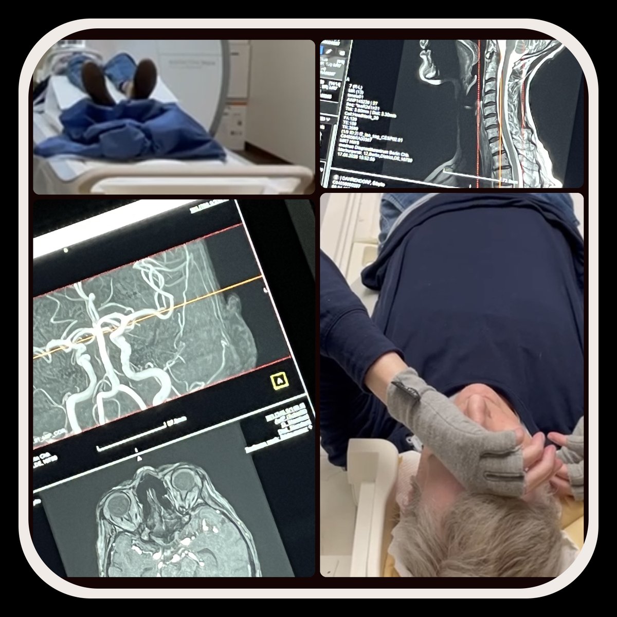 Sibylle im #MRT: Brain &amp; Spine #CCI: Man war das anstregend. Und so traurig durch die Stadt zu fahren, gefahren zu werden, all die Menschen zu sehen, in den Strassencafés. 

Festgestellt wurde: Zerebrale Mikroangiopathie, eine Erkrankung, die die kleinen Blutgefäße im Gehirn (!!)