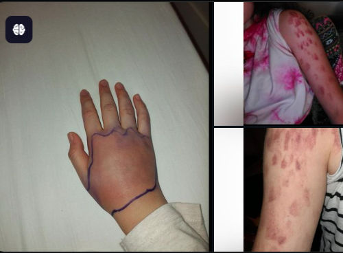 sepa tamer tweet media