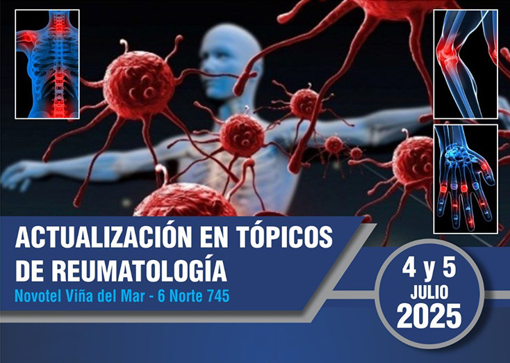 La Filial Centro de SOCHIRE te invita al curso “Actualización en Tópicos de Reumatología”, que se realizará el 4 y 5 de julio en el Novotel Viña del Mar. Una instancia clave para compartir avances clínicos y experiencias en reumatología.
Inscríbete en: fundacionlucassierra.cl/.../actualizac…