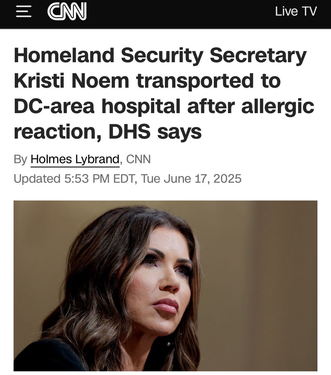 Allergic reaction to what? Botox?