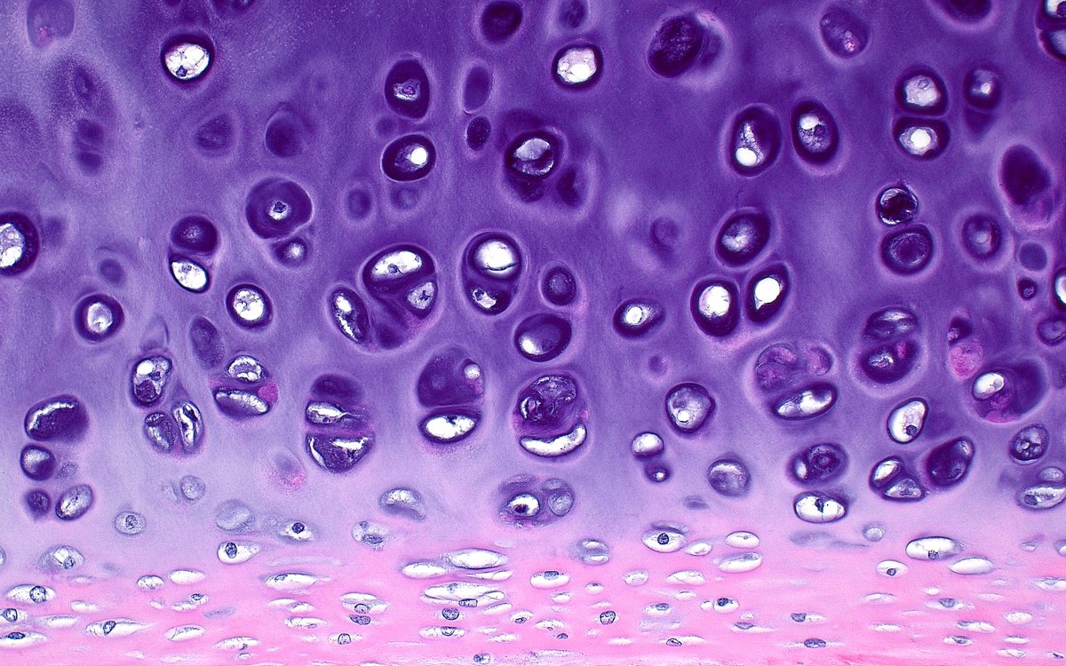 ziad_zaatari's tweet image. 🔬 The Beauty of Cartilage ~ Hyaline cartilage from a the wall of a trachea ~ #Pathology #Histology #PathArt 🎨📸