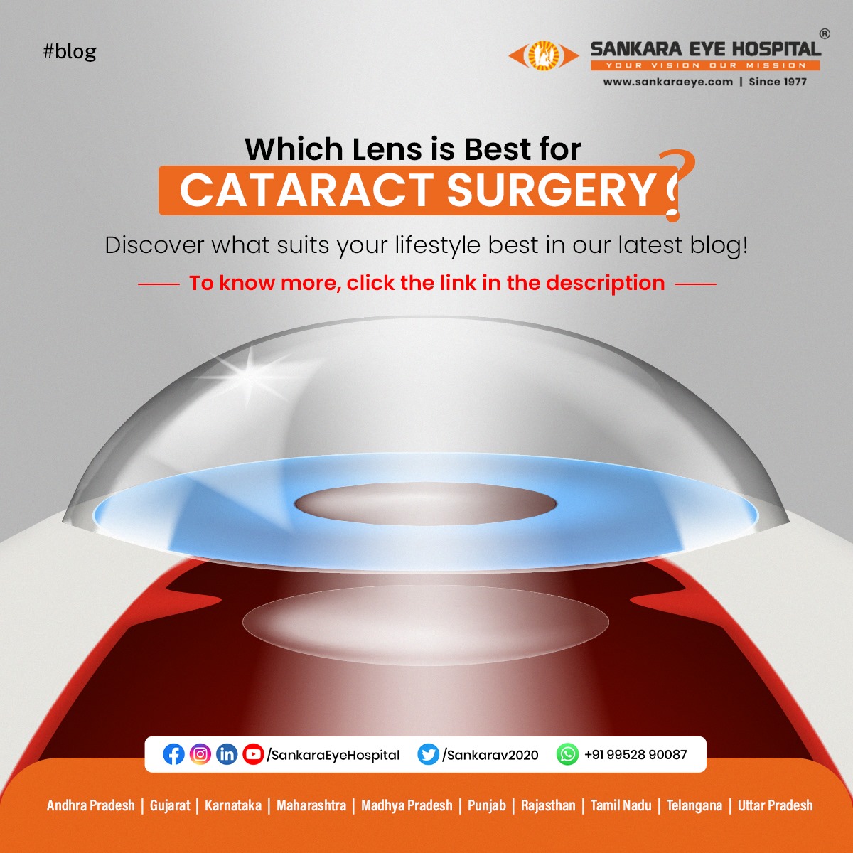 Confused about which lens to choose for your cataract surgery?
Your lifestyle, vision needs, and daily habits play a big role in selecting the right lens.

👉 Click the link to read more: sankaraeye.com/blog/which-len… 

Your vision, your choice — guided by the best.

#CataractSurgery