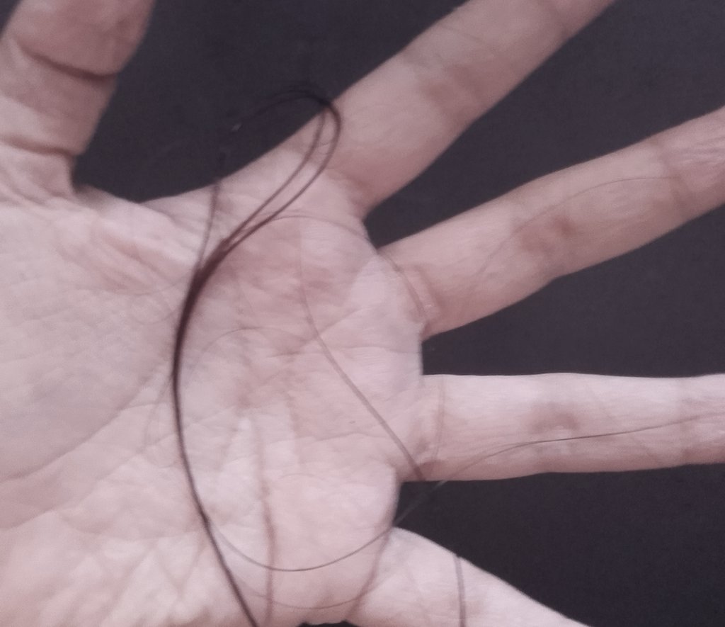Nxcrotetsu's tweet photo. My hair falls out in clumps, I can't eat, I can't drink water, I can't sleep, maybe my body will accept its fate, get rot and everyone will forget about me https://t.co/ge8Xqeutwk
