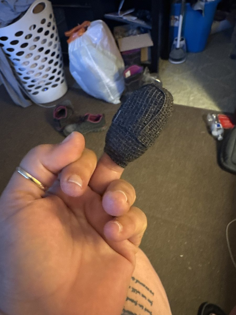 Today’s updated finger pic. It’s healing good. And this is how I keep it clean