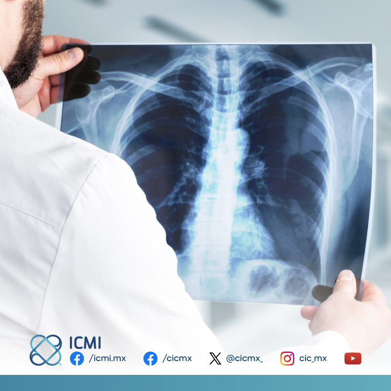 cicmx_'s tweet photo. #Conocimiento_CIC
¿Qué puede mostrar una radiografía de tórax?
#Radiografía #Pulmones #Corazón #Torax
👉¿Necesitas una valoración médica? Clínica especializada en Insuficiencia Cardíaca.
☎ 33 3621 0808
📱 WhatsApp 3316031390 https://t.co/BjP2BgXMty