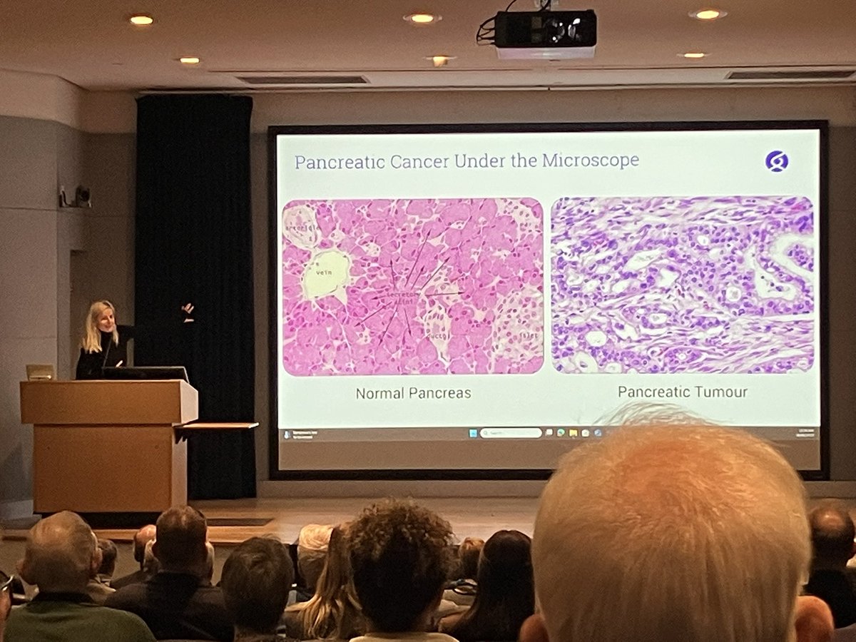 Personalised Cancer Therapeutics Lab (@pajiclab) on Twitter photo Our lab head <a href="/DrMarinaPajic/">Marina Pajic</a>, along with <a href="/AnthonyMJoshua/">GrumpyOncologist</a> and <a href="/PurpleOurWorld/">Purple Our World</a>’s Daniel Goulburn OAM delivered an inspiring public seminar today at <a href="/GarvanInstitute/">Garvan Institute of Medical Research</a> on how we are working to improve outcomes for patients with #PancreaticCancer. Our lab head <a href="/DrMarinaPajic/">Marina Pajic</a>, along with <a href="/AnthonyMJoshua/">GrumpyOncologist</a> and <a href="/PurpleOurWorld/">Purple Our World</a>’s Daniel Goulburn OAM delivered an inspiring public seminar today at <a href="/GarvanInstitute/">Garvan Institute of Medical Research</a> on how we are working to improve outcomes for patients with #PancreaticCancer.