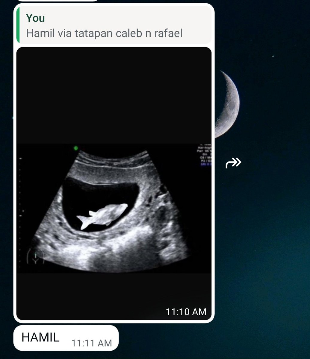 Vincent Cerbero 🐺【Yorukaze】 tweet media