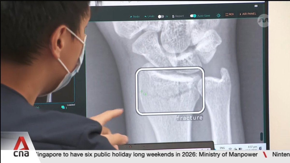 We are overjoyed to receive an honorable mention for our efforts in accelerating AI adoption. Watch CARPL in action, mentioned by Singapore’s Minister for Health, Mr Ong Ye Kung, at Synapxe AI Accelerate conference (Video courtesy CNC): lnkd.in/gdnekrNy