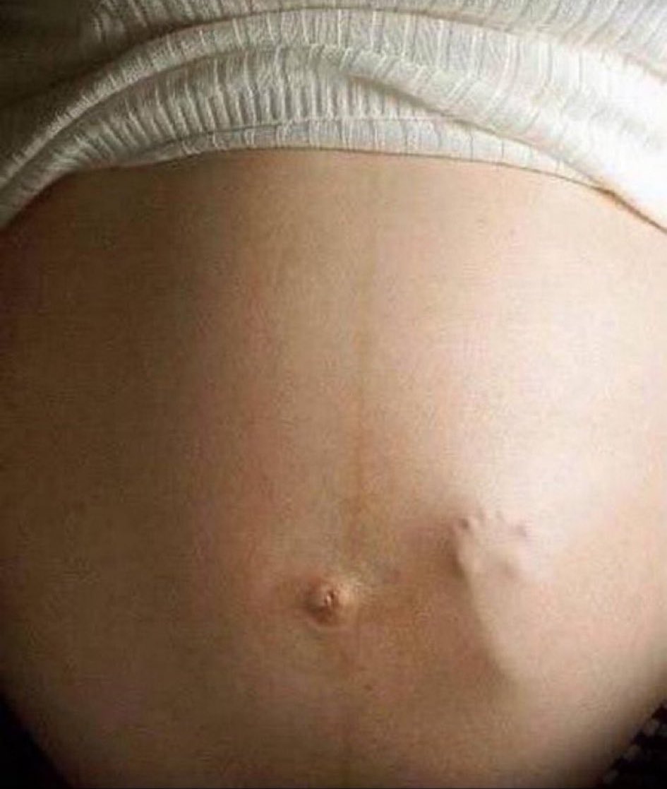 Jason (@jasondsibley) on Twitter photo Quick note for #MiltonKeynes residents.
Our MP - <a href="/emily4MK/">Emily Darlington MP</a> - voted against terminally sick elderly to be able to die with some dignity and for mothers to be able to murder a baby up to full term delivery.
She even posts that it’s a huge win for women’s rights. Celebrating the Quick note for #MiltonKeynes residents.
Our MP - <a href="/emily4MK/">Emily Darlington MP</a> - voted against terminally sick elderly to be able to die with some dignity and for mothers to be able to murder a baby up to full term delivery.
She even posts that it’s a huge win for women’s rights. Celebrating the