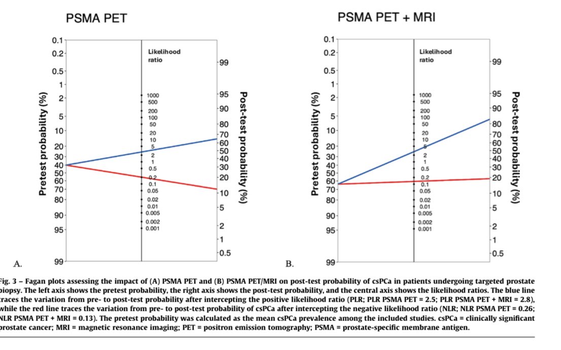 Sabine D. Brookman-May (@brookmans76) on Twitter photo Excellent comprehensive review + metaanalysis on the diagnostic role of #PSMA Pet in #ProstateCancer
✅ High diagnostic value of PSMA PET, especially when combined with #MRI
✅ NPV indicates limitations to guide LND - not enough to omit biopsy
<a href="/EUplatinum/">European Urology</a> <a href="/oncodaily/">OncoDaily</a> <a href="/elio_mazzone/">Elio Mazzone</a> Excellent comprehensive review + metaanalysis on the diagnostic role of #PSMA Pet in #ProstateCancer
✅ High diagnostic value of PSMA PET, especially when combined with #MRI
✅ NPV indicates limitations to guide LND - not enough to omit biopsy
<a href="/EUplatinum/">European Urology</a> <a href="/oncodaily/">OncoDaily</a> <a href="/elio_mazzone/">Elio Mazzone</a>