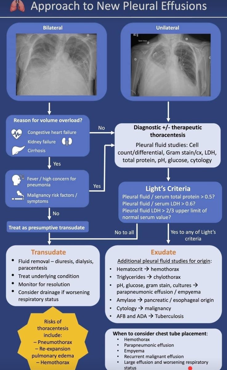 Approach to New Pleural Effusion