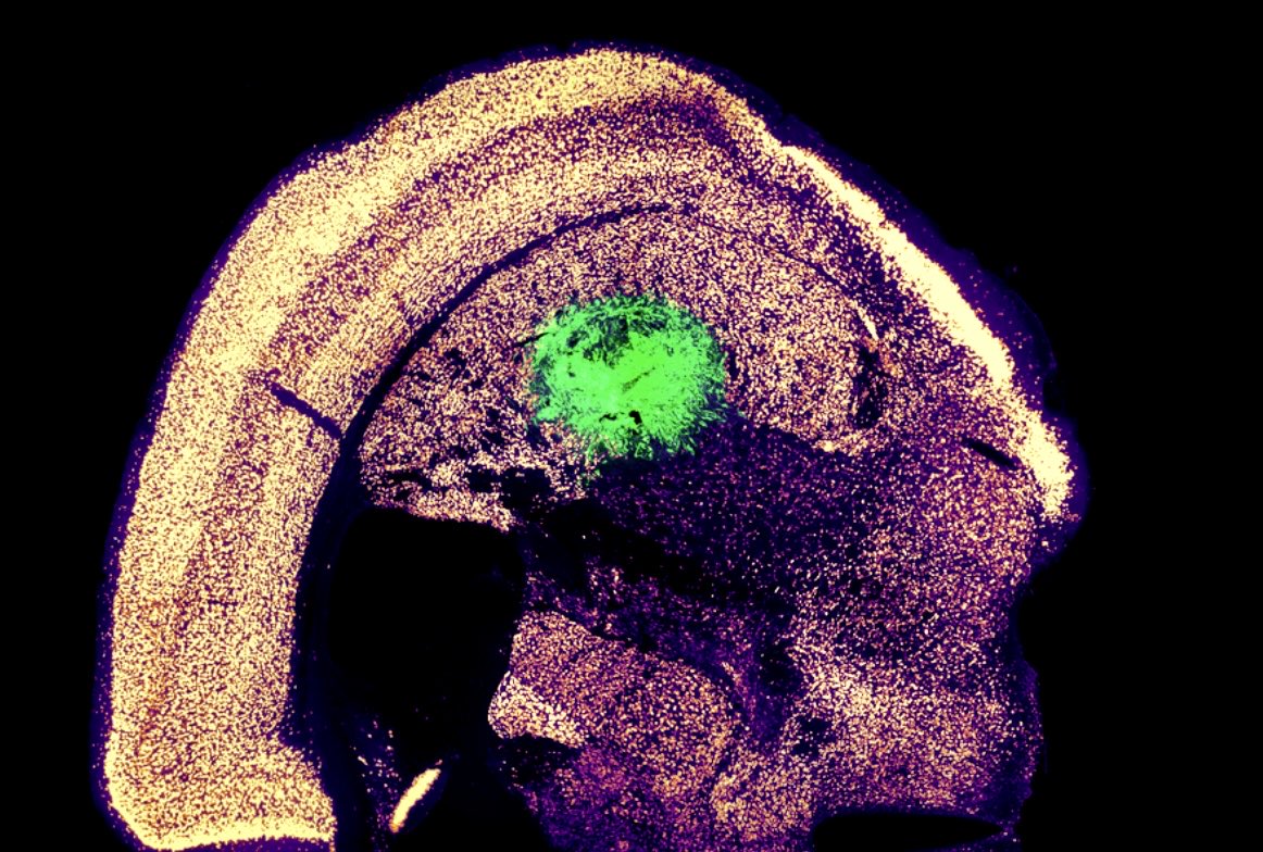 enilev's tweet image. 💥 Skipping the Stem Cell stage entirely 

🧠 MIT engineers have figured out how to turn skin cells directly into neurons — skipping the stem cell stage entirely. This could fast-track therapies for #spinalcord injuries, #ALS and more

#Neuroscience #Neurotech #SkinCells #Neurons…