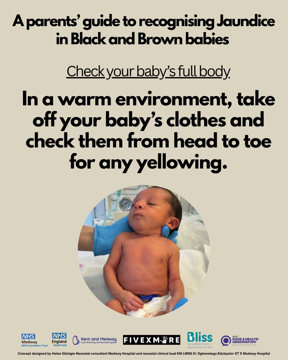fivexmore's tweet image. Do you know how to spot Jaundice on Black babies?

We’ve been working behind the scenes on a new resource designed to support and empower Black and Brown parents and it’s finally here.

In collaboration with Bliss, NHS Medway, Kent and Medway Neonatal Network, NHS England South…
