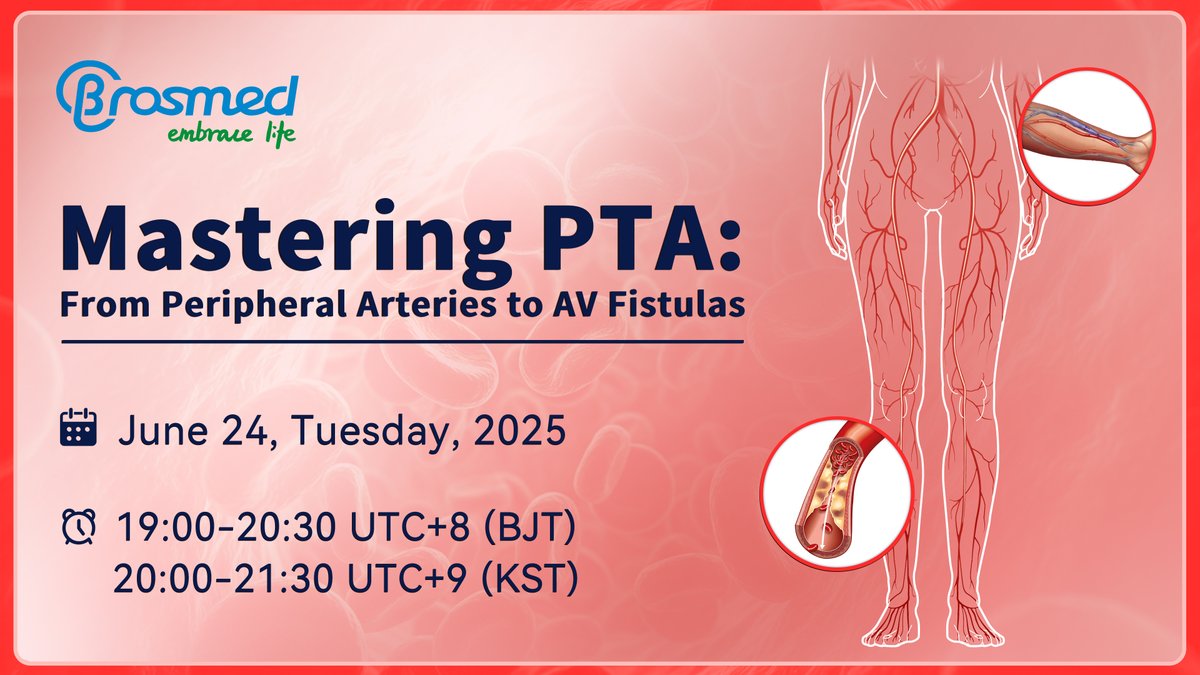 Join us on Tuesday, June 24  🕒 19:00–20:30 (UTC+8) !
Dive into "Mastering PTA: From Peripheral Arteries to AV Fistulas"with top experts. Don't miss this opportunity to gain insights and clinical wisdom from global leaders in the field. Register now! 🔗global.drvoice.cn/v2/course/3735