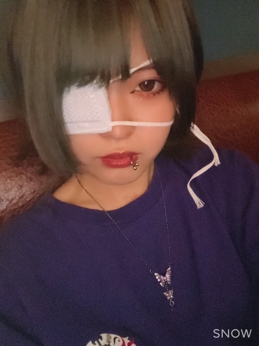 目がかぶれて眼帯でー👀