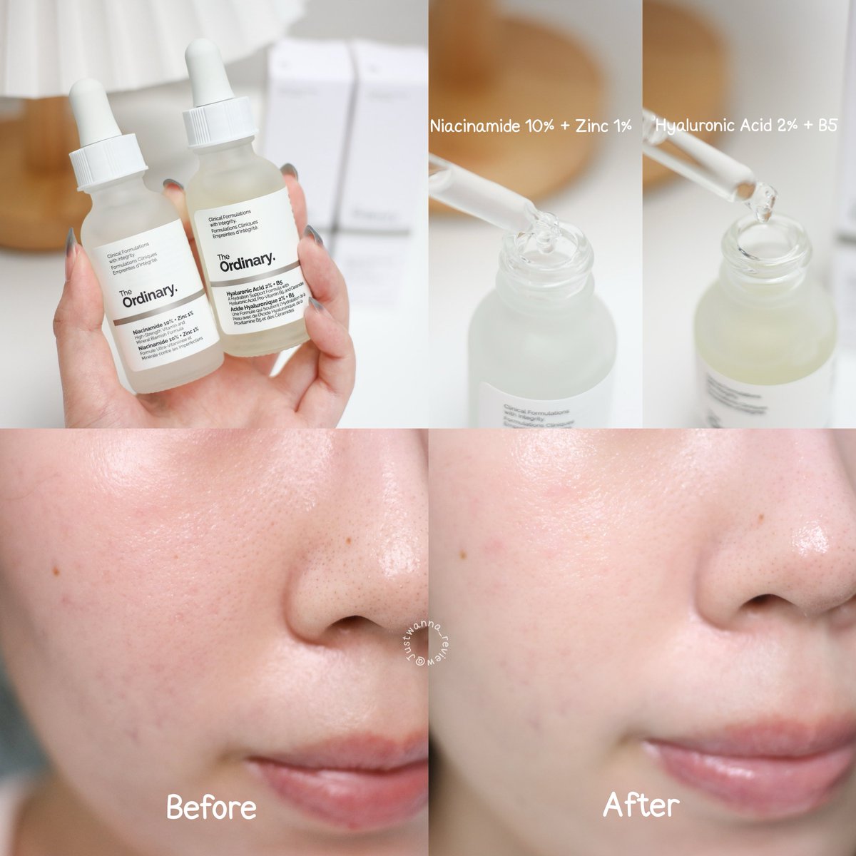 นี่ใช้ The Ordinary Niacinamide 10% + Zinc 1% มาตั้งแต่สมัยเรียน เป็นสกค.ที่มีติดบ้านตลอด🤍 ช่วยลดความมันไม่ทำให้เกิดสิว เพิ่ม ลดการอุดตัน ยิ่งมี Niacinamide ด้วยช่วยให้ผิวกระจ่างใสเรียบเนียนขึ้น ช่วงนี้คือรูขุมขนกว้างมากๆหลังใช้ตัวนี้คือรูขุมขนกระชับขึ้นจริงๆ