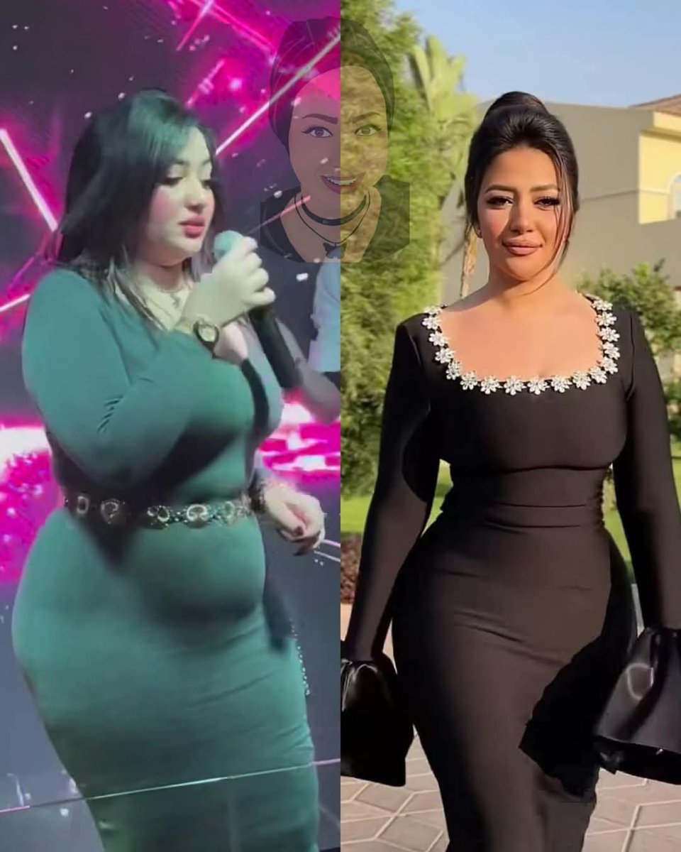 رحمة محسن قبل وبعد احمد العوضى وعشر الاف دولار بس