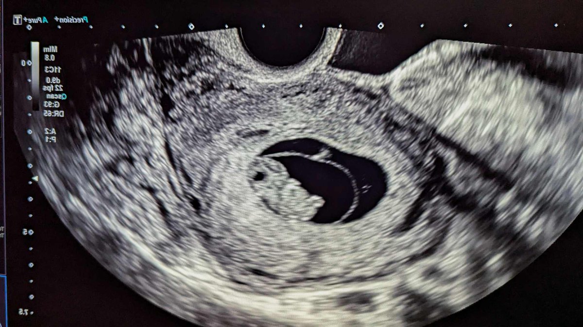 Christina Erne tweet media