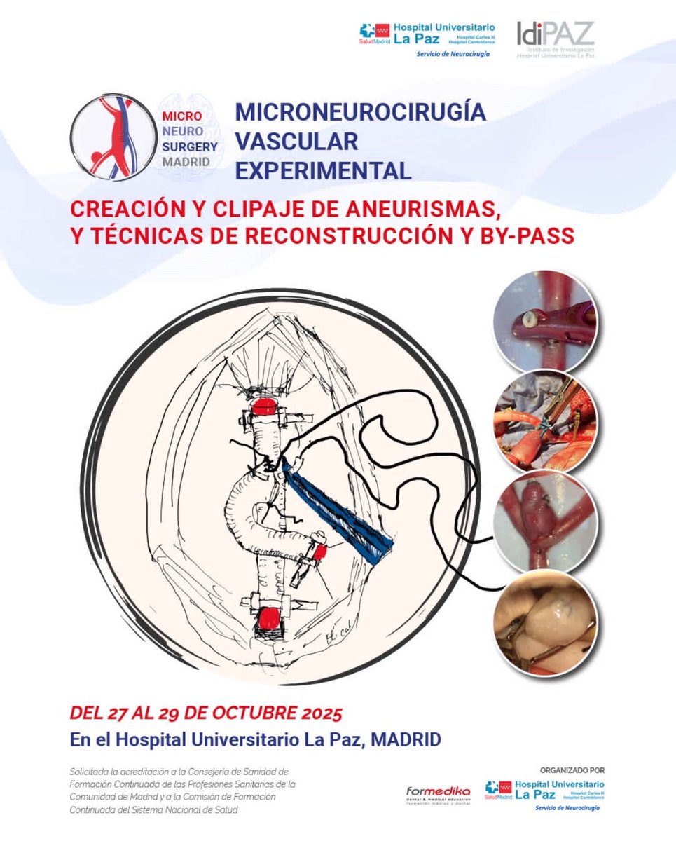 GFeijoo_NS's tweet photo. •Microneurocirugía Vascular Experimental: Creación y clipaje de aneurismas y técnicas de reconstrucción y bypass.🐁🔬
•📅 27-29 Octubre 2025
•📍idiPAZ, H.U. La Paz, Madrid🇪🇸
¡Si te interesa la microcirugía no te lo pierdas!
•Más info en🧑🏻‍💻ℹ️: https://t.co/aSUDCUUTpw https://t.co/hm16XtxlYv