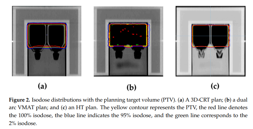 Findings highlight the importance of integrating radiobiological assessments with physical dose metrics to inform the clinical application of advanced RT technologies.
pubmed.ncbi.nlm.nih.gov/40427718/

 #Radixact