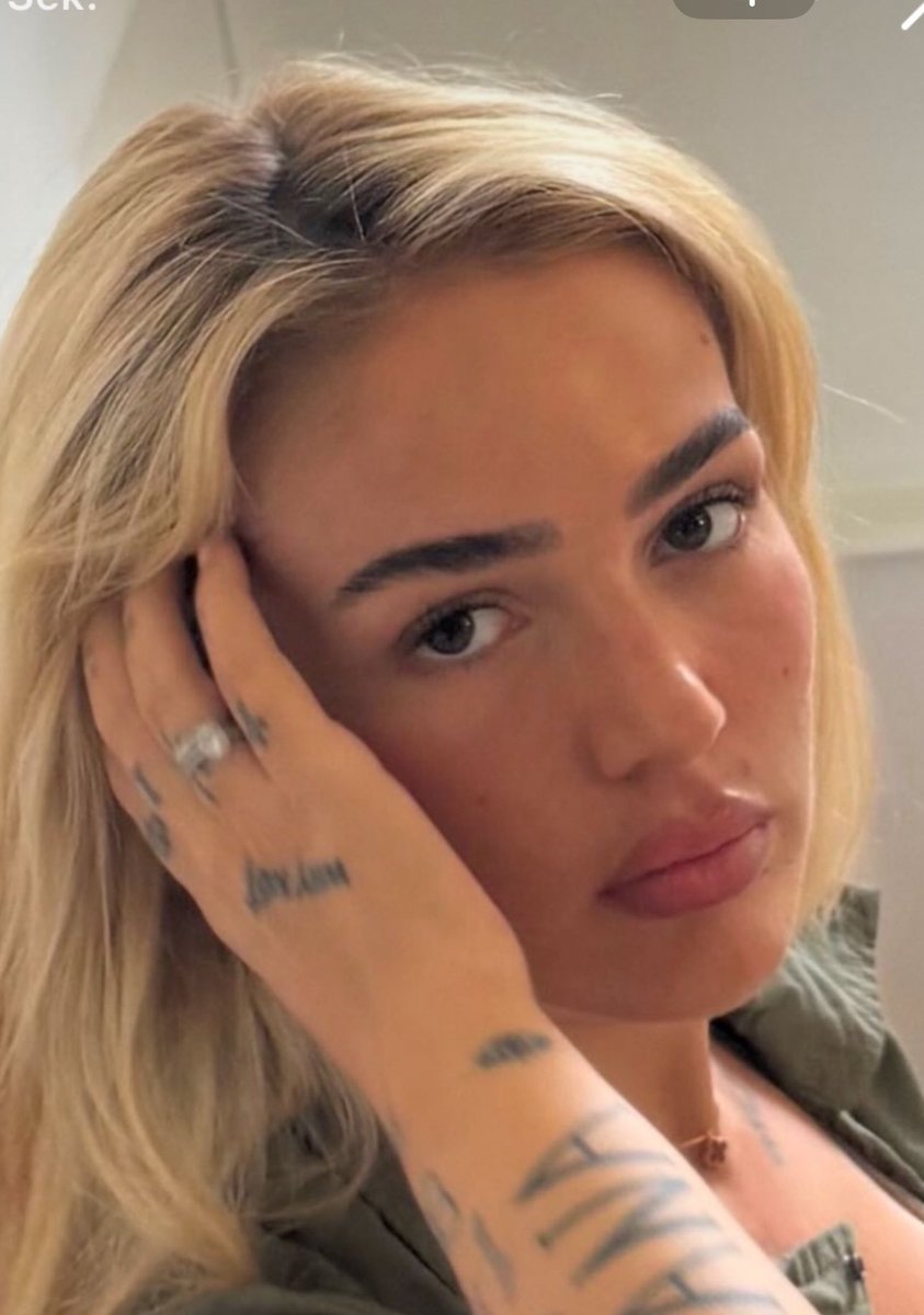 🚨Loredana hat sich ihre Lippen und Wangen auflösen lassen😍