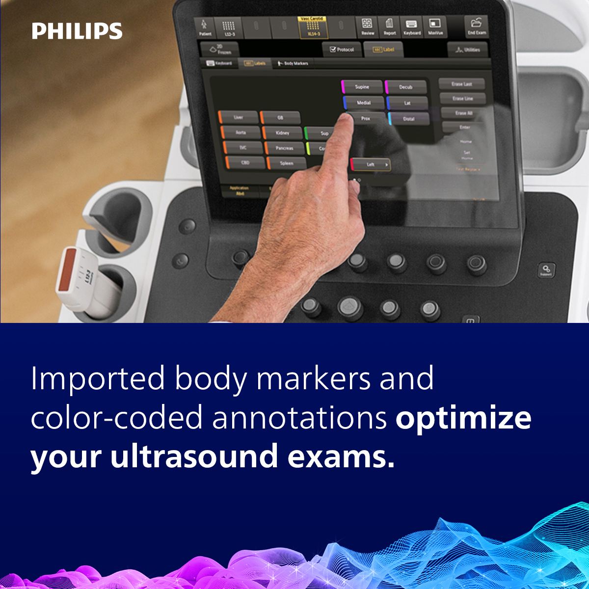 IngArnott's tweet photo. Less user interaction – more time with your patients. ​Intuitive automated workflows support you on a quicker path to first-time right diagnosis and planning.​

#ElevateUltrasound #AbdominalUltrasound #UltrasoundWorkflow #PhilipsUltrasound #RadiologyUltrasound https://t.co/7nbxAkMviF