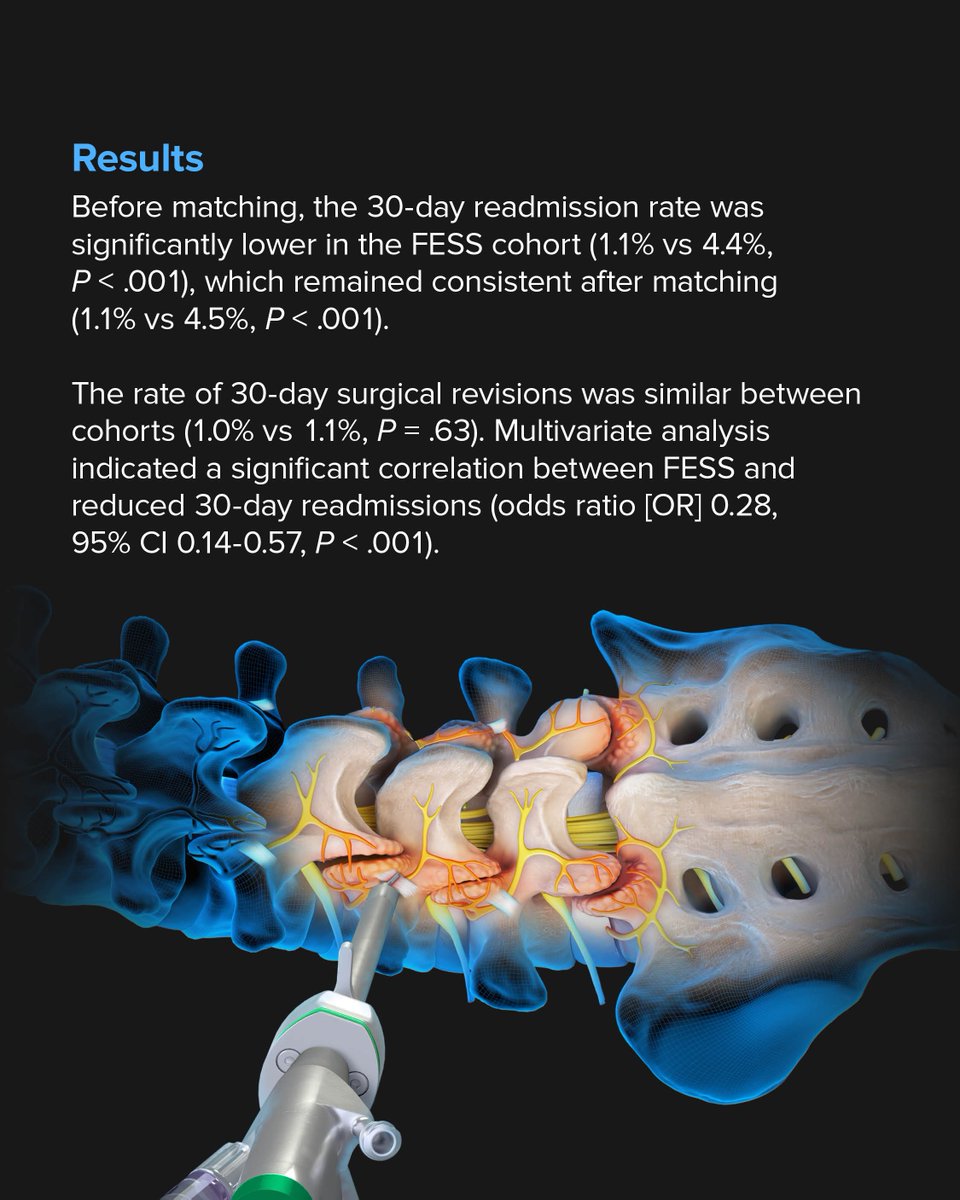 ArthrexSpine's tweet image. “Endoscopic spine surgery demonstrates a shorter hospital stay, reduced 30-day readmissions, fewer infections—it’s not magic, it’s just better,” said Arthrex faculty surgeon Mark Mahan, MD.
This study is the first to compare 30-day hospital readmissions between full-endoscopic…