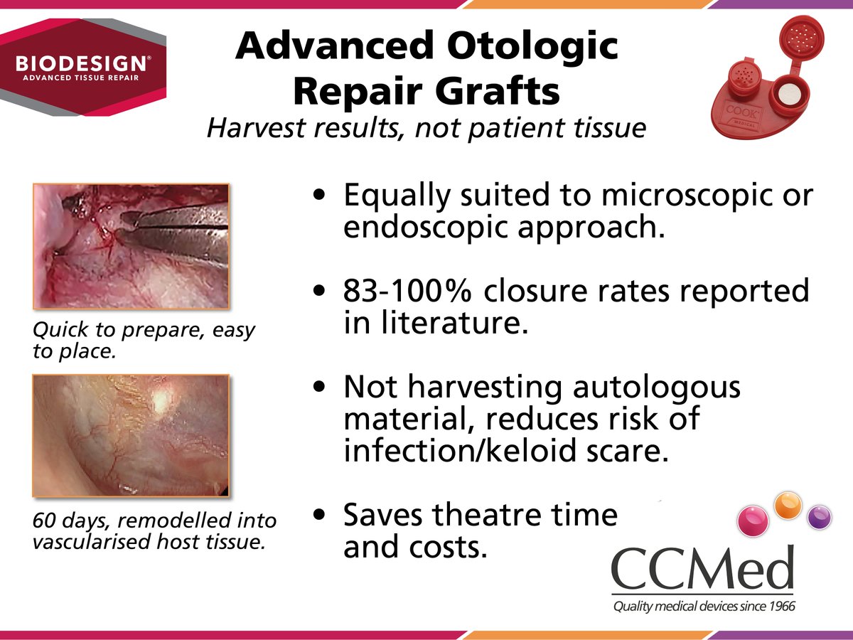 Otologists all over the UK and Ireland trust Biodesign to provide great closure rates without having to harvest host tissue. Saves time &amp; costs with great outcomes

Visit CCMed.co.uk 

#ENT #otologist #otology #tympanoplasty #tympanic-membrane #tissue-repair