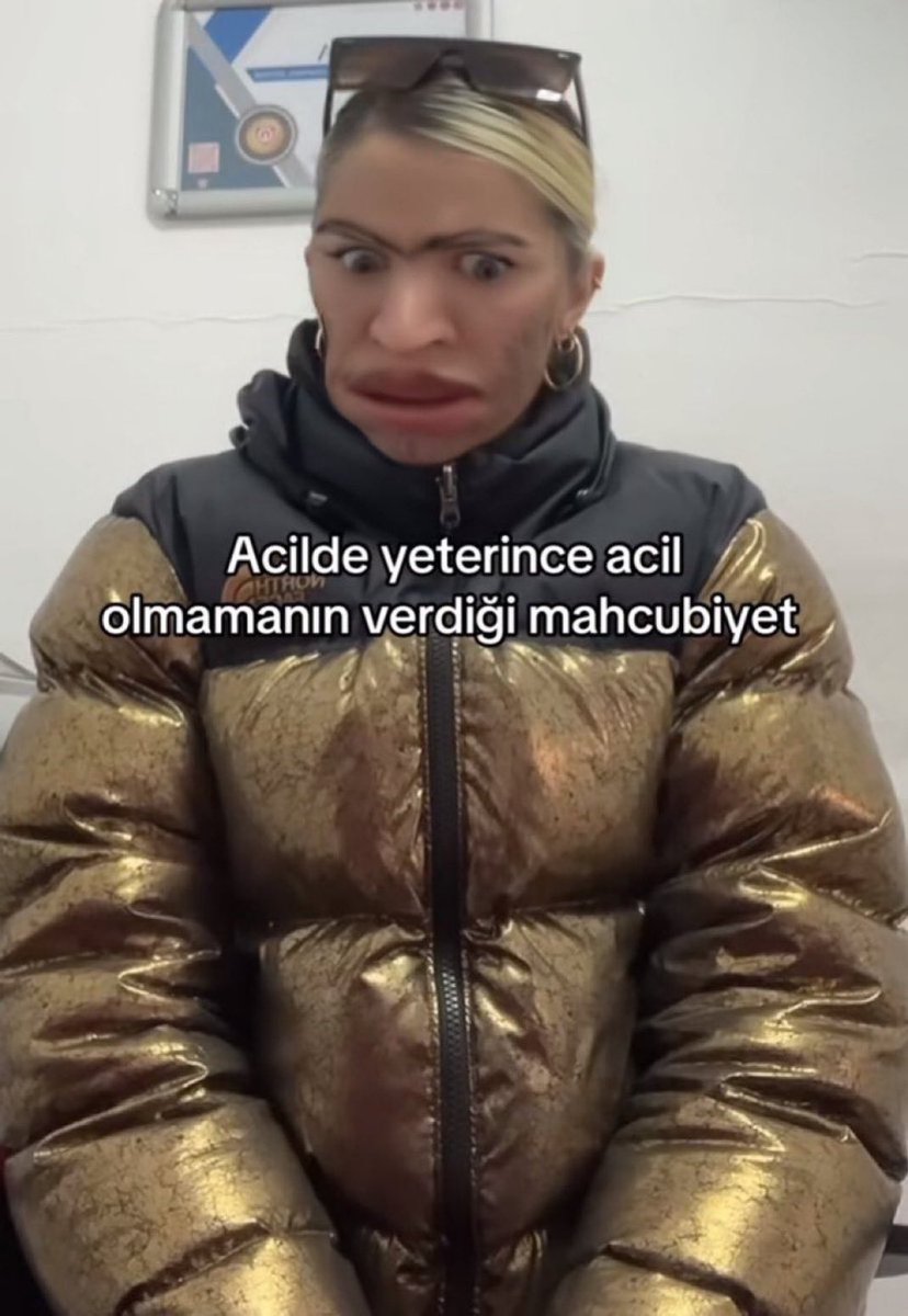 EftalBey (@artikbisaiin) on Twitter photo 