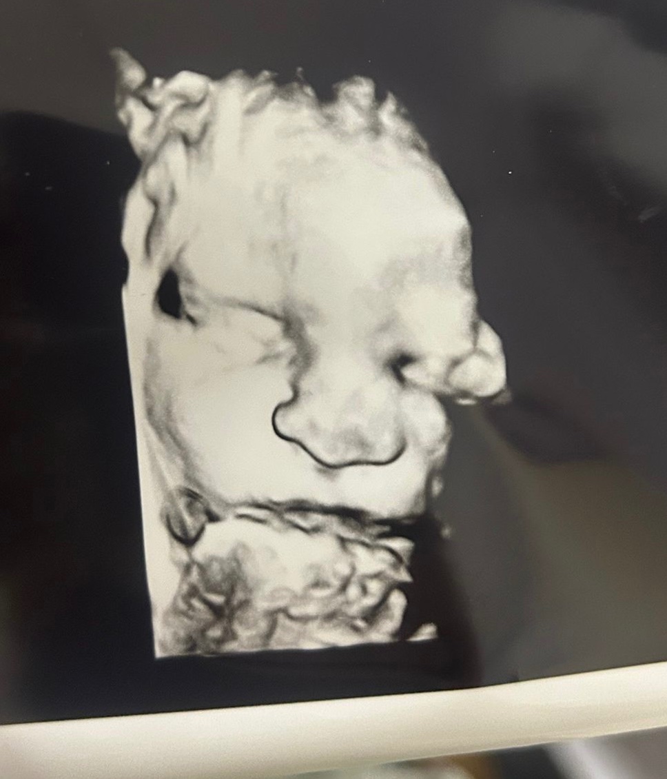 OliviaUtley's tweet image. A baby in the womb on 19th Dec and out of the womb on 25th Dec.
Same baby, same week, wildly different rights 🤯