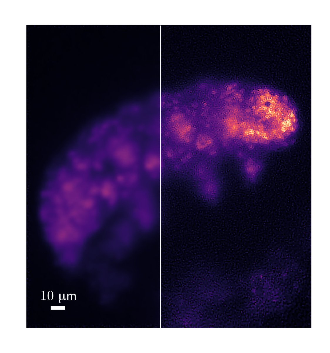 Microscopes have a problem: fuzzy edges.
Amit Kohli’s research fixes that with a single snapshot and a clever deblurring algorithm.
Better images, without bigger hardware.