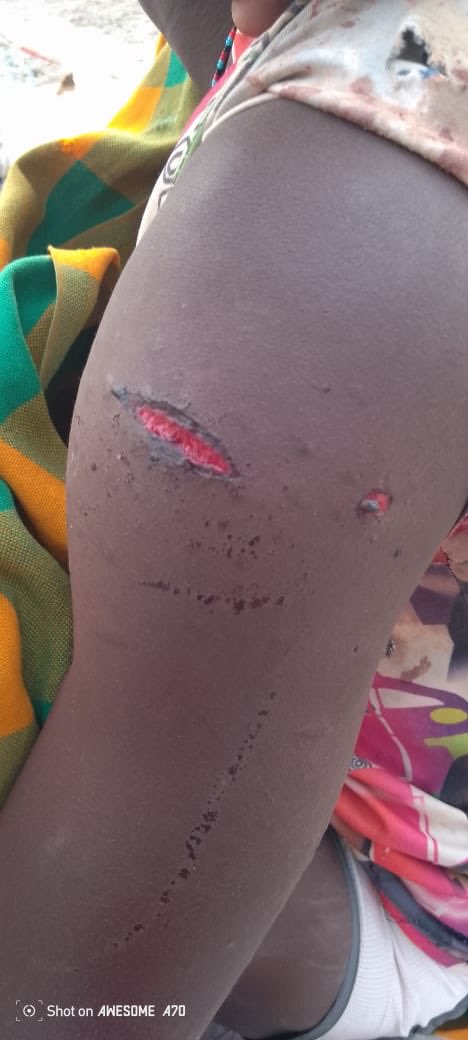 Hon Ekwom NABUIN, MP (@ekwomnabuin) on Twitter photo One person shot and wounded in Lake Turkana water by <a href="/KWSKenya/">Kenya Wildlife Service</a> rangers based in Sibiloi despite President <a href="/WilliamsRuto/">William Samoei Ruto, PhD</a> directive to stop the massacre of Turkana Fishermen. KWS DG must take personal responsibility for the killings that have continued unabated. We’re going to One person shot and wounded in Lake Turkana water by <a href="/KWSKenya/">Kenya Wildlife Service</a> rangers based in Sibiloi despite President <a href="/WilliamsRuto/">William Samoei Ruto, PhD</a> directive to stop the massacre of Turkana Fishermen. KWS DG must take personal responsibility for the killings that have continued unabated. We’re going to