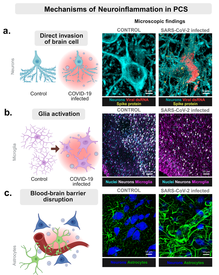 My interpretation of the potential mechanisms involved in post-COVID-19 neuroinflammation #LongCovid #NeuroCovid 2/3