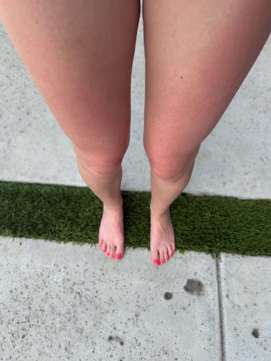 NoFaceRowan's tweet photo. Ready for summer! ☀️👣 https://t.co/k2S3mjlURQ