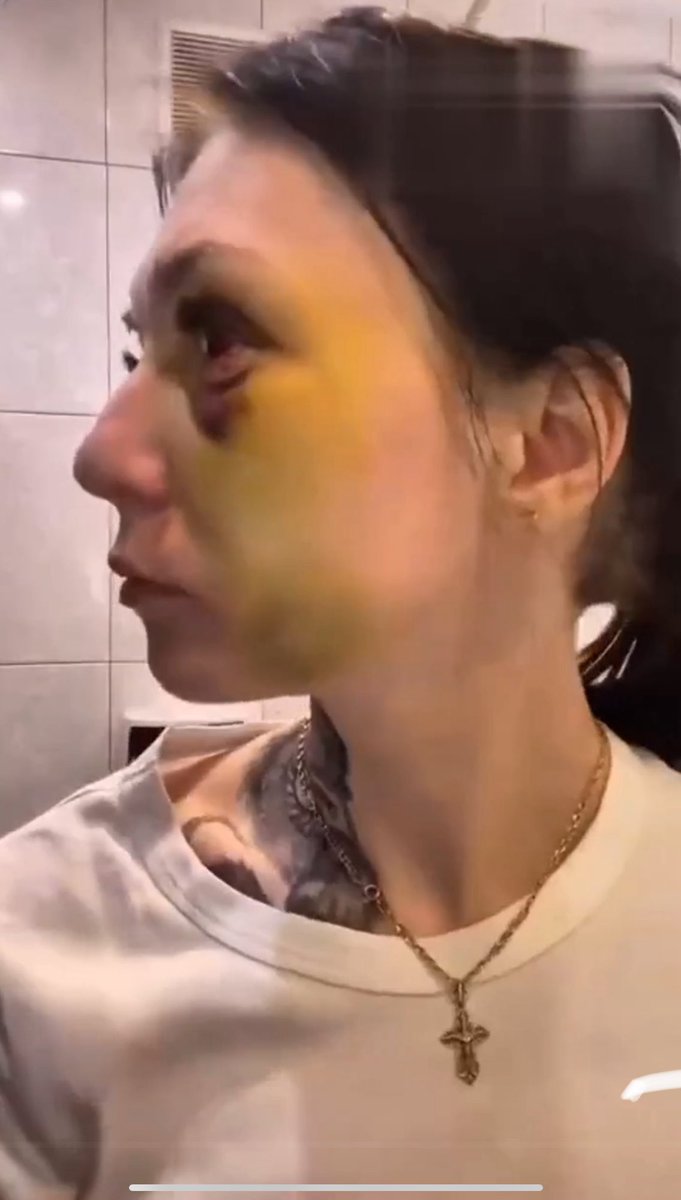 Девушка годами терпела жестокие побои, а близкие не верили ей и утверждали, что «сама виновата»: жуткая история из Смоленска

Регина рассказала в соцсетях об отношениях со своим парнем — Алексеем Соколовым. По её словам, сначала у них всё шло просто прекрасно, но затем мужчина