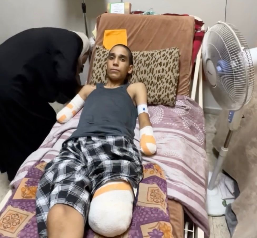 nahed_hajjaj99's tweet image. This is 14-year-old AbdelKarim Abuamsha, shrapnel from an airstrike cut all his limbs while he was sheltering in a school.
He must be evacuated immediately. There are thousands of children that need to be evacuated! Let them live.