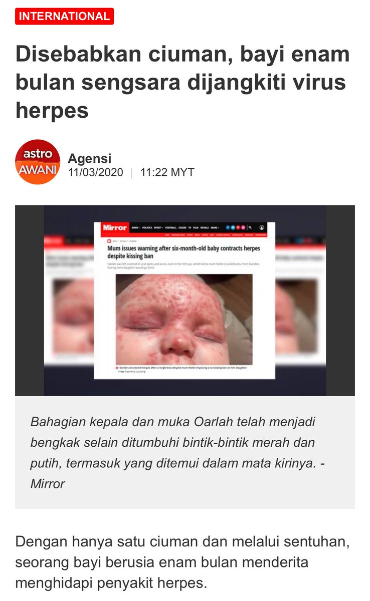 natashagideon's tweet photo. Nak mintak cytro viralkan benda macam ni dekat WhatsApp. Benda tak betul selalu dah viral “forwarded many times”. 

“Ala cium sikit je”

Kalau tak mati pun, tak pepasal kena jangkitan herpes forever. Tapi tu lah nak kena mati baru nak faham ke? https://t.co/BBoXoNEi3H