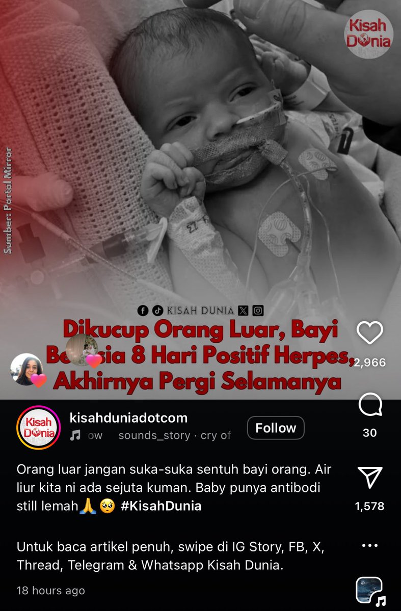 natashagideon's tweet photo. Nak mintak cytro viralkan benda macam ni dekat WhatsApp. Benda tak betul selalu dah viral “forwarded many times”. 

“Ala cium sikit je”

Kalau tak mati pun, tak pepasal kena jangkitan herpes forever. Tapi tu lah nak kena mati baru nak faham ke? https://t.co/BBoXoNEi3H