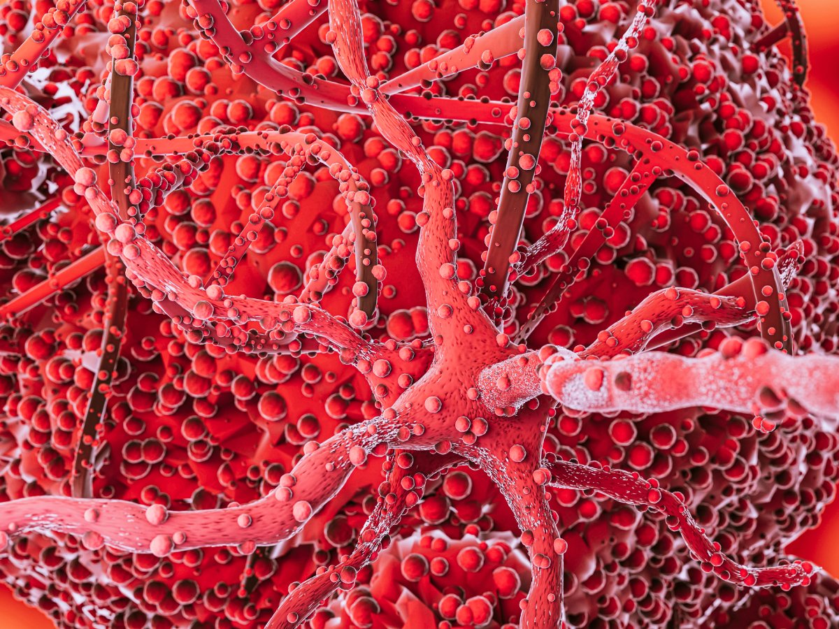 jmirpub's tweet image. New JMIR BioMedEng: Pump-Free Microfluidics for Cell Concentration Analysis on Smartphones in Clinical Settings (SmartFlow): Design, Development, and Evaluation dlvr.it/TLRCjb #Microfluidics #CellConcentration #SmartphoneTechnology #ClinicalDiagnosis #Biotechnology