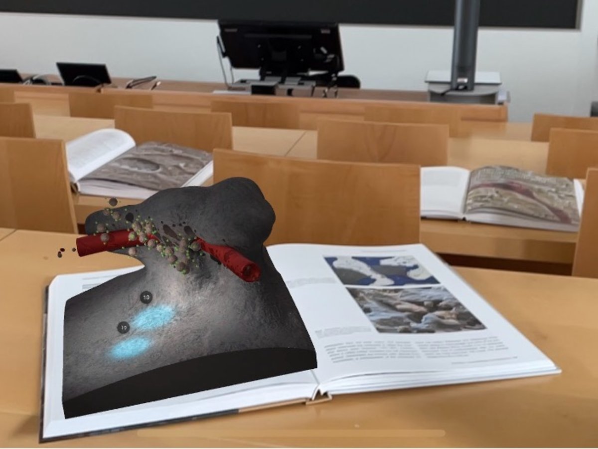 JMIR Serious Games: Applying Augmented Reality to Convey Medical Knowledge on Osteoclasts to Users of a Serious #Game: Vignette Experiment dlvr.it/TLRDDL