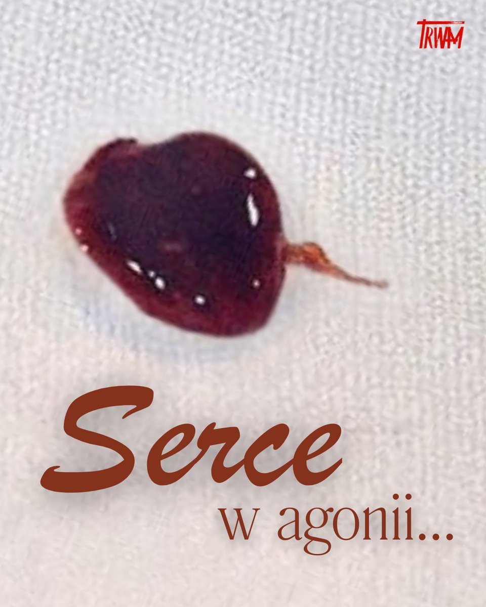 🩸 CUDA EUCHARYSTYCZNE 🩸
„Odczytujemy ten przedziwny znak jako szczególny wyraz życzliwości i miłości Pana Boga, który tak bardzo zniża się do człowieka…”.
(bp Zbigniew Kiernikowski) 🔸