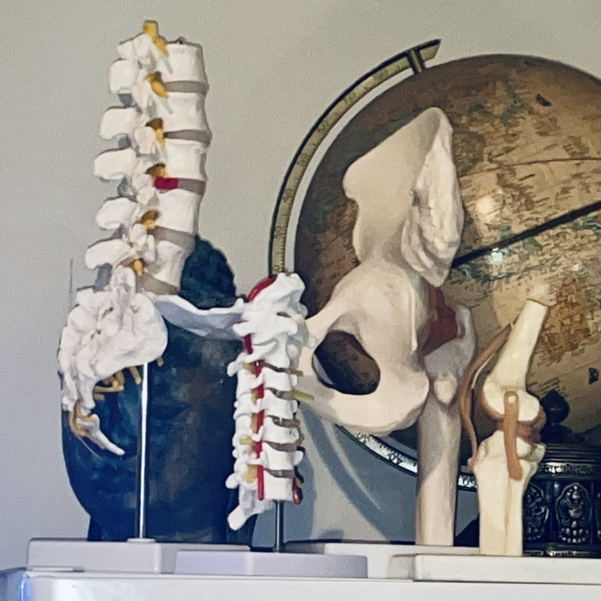 gurusculler's tweet photo. All the bits I’ve had repaired or replaced, culminating in the neck fusion. Previously lumbar spine fusion, + knee & hip replacements.
#bionicman #cyborg https://t.co/rJnGaemkxi