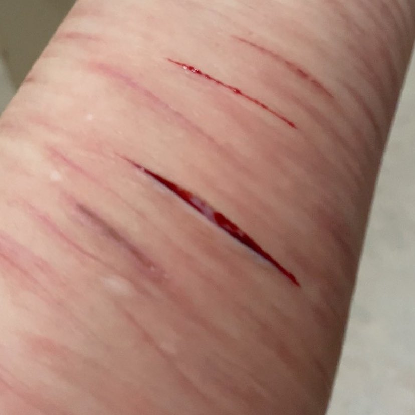 AngelOfSHTWTT's tweet photo. I miss being able to go this deep

Shtwt slittertwitter https://t.co/mzBkzaTPpY