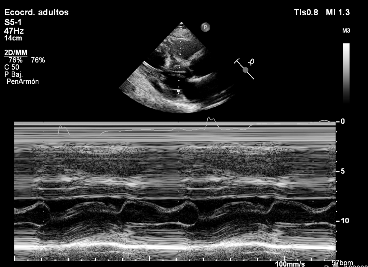 Juan Pablo Costabel MD 🇦🇷 tweet media