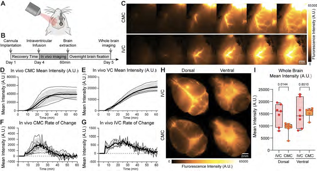 thmonk_pf's tweet image. 脳lymphatics研究に於る新手技として慢性側脳室cannulationを開発
従来の大槽注入の制約を克服し覚醒mouseのtrace注入と同一個体の反復投与を実現
72時間回復期間後、生理学的な脳lymph流入patternが再現され縦断的評価が可能となった

OA

#glymphatics 
#methods 
#papers 
doi.org/10.1523/ENEURO…