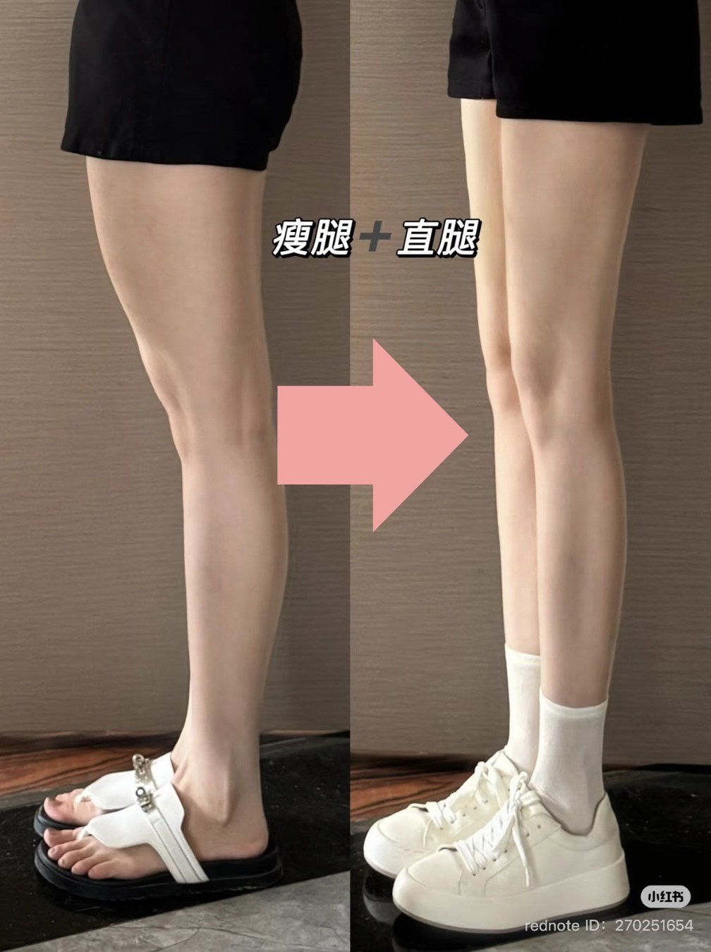 とても良いし、足痩せに使えます！ Lose 5cm in 2 weeks] You can do it while you sleep 🔥 14-day