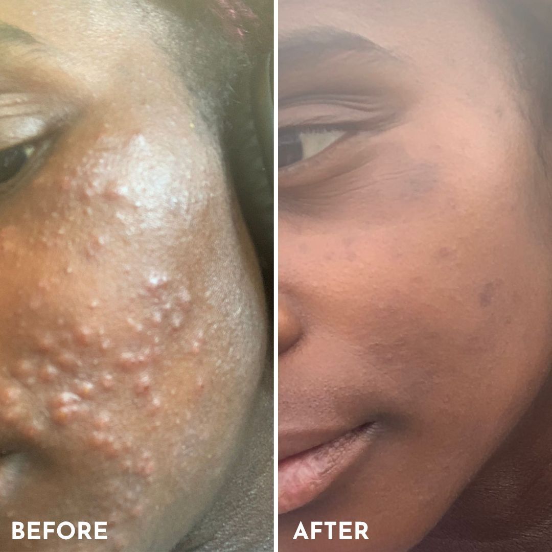 This is what just 3–4 weeks of consistency can do.

MIMO Cleansing Balm + Serum

No filters. No shortcuts. Just skin that speaks for itself. 🌿 

Get MIMO at @harrods B MK <a href="/superdrug/">Superdrug</a> <a href="/willenhospice/">Willen Hospice</a> <a href="/rackhams_retail/">Rackhams</a> The Hair and Skin Clinic MK or visit: buff.ly/xOOG0d1